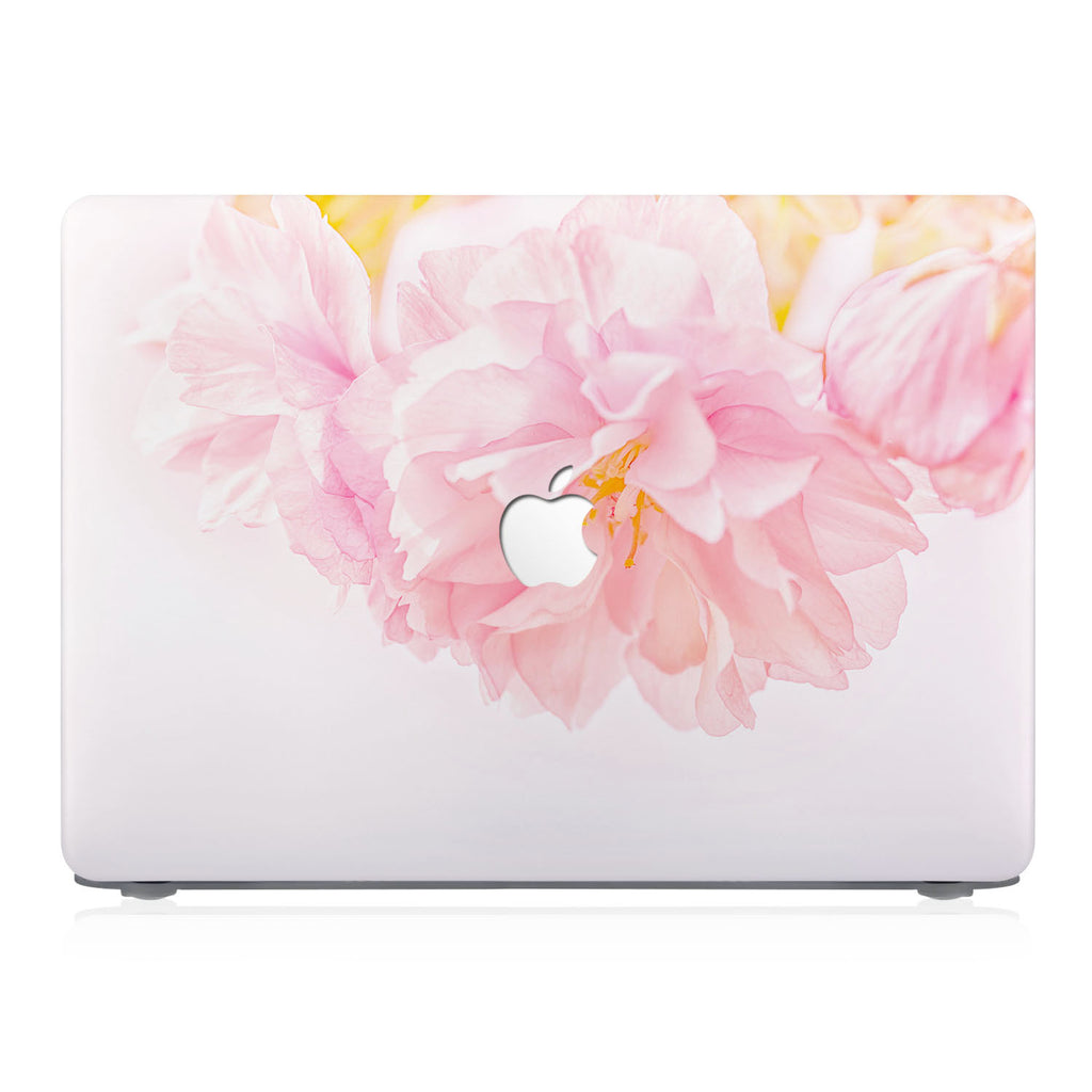 This lightweight, slim hardshell with 5 design is easy to install and fits closely to protect against scratches